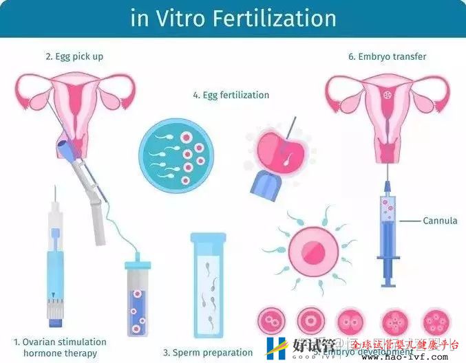 做一个试管婴儿要花多少钱医保能报销吗(图4)