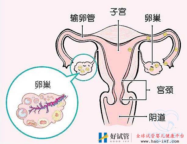 排卵障碍能做试管婴儿吗？成功率多少？(图1)