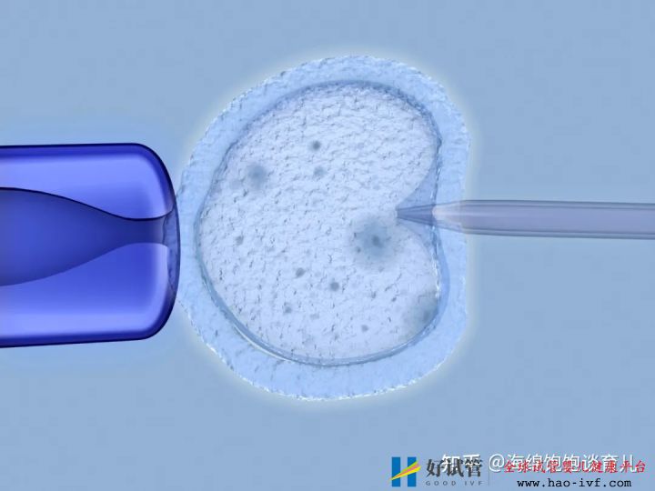 试管婴儿1代、2代、3代、4代哪个最好真实操作过...(图12)