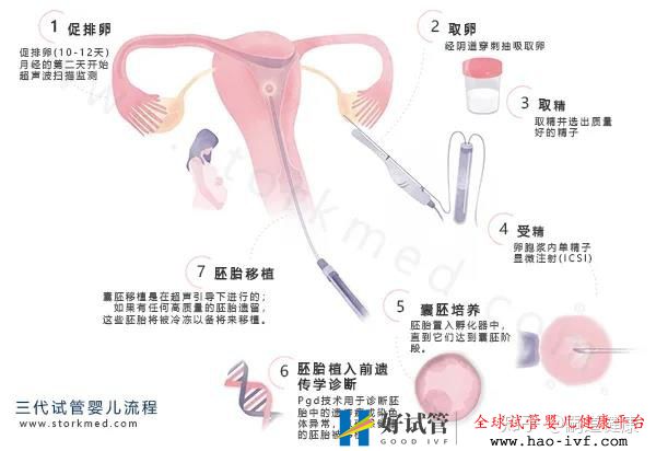 【干货】这张《第三代试管婴儿流程图》,一目了然,...(图1)