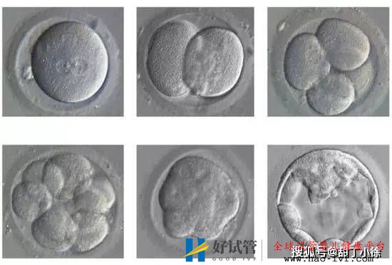 试管婴儿移植后多久算成功(图1)