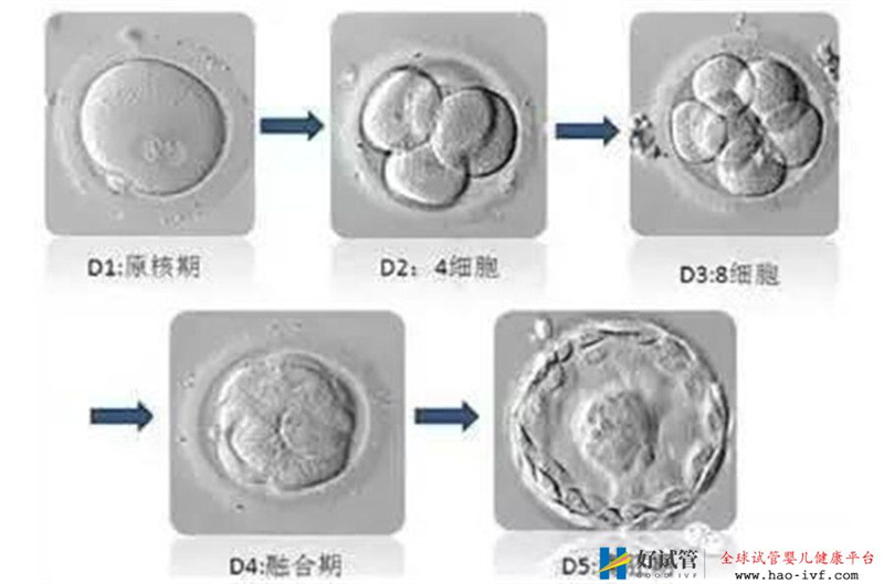 看完这篇试管婴儿养囊的利弊，你会继续选择养囊吗？(图2)