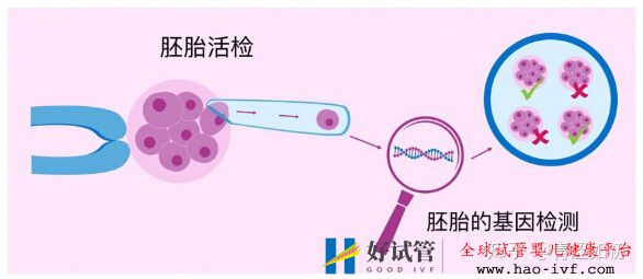 试管婴儿的利弊分析(图1)