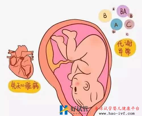 试管婴儿可以杜绝先天性心脏病吗？这个答案你得知道(图1)