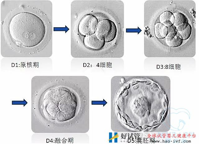 试管婴儿冻胚和鲜胚哪个成功率高(图1) 试管婴儿冻胚和鲜胚哪个成功率高(图1)