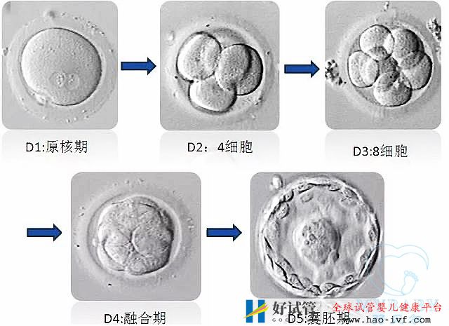 试管婴儿冻胚和鲜胚哪个成功率高(图1)