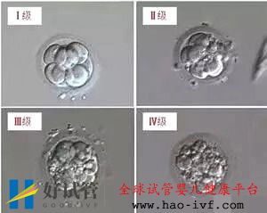 泰国试管婴儿鲜胚，囊胚，冻胚，哪个移植成功率更高(图1)