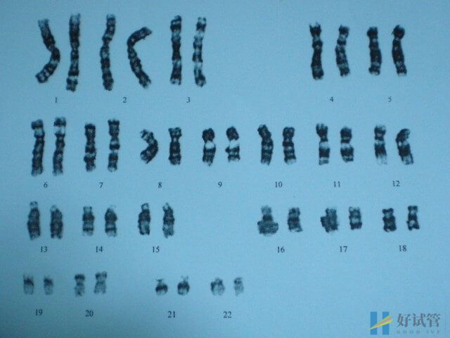 染色体14pss不会影响女性生育能力