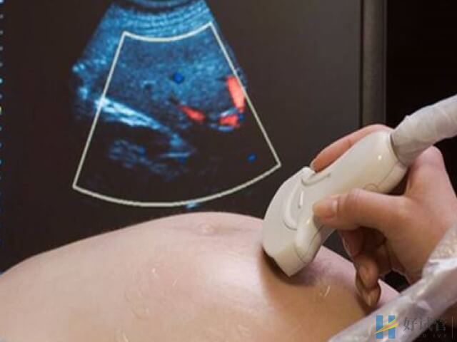 胎儿18号染色体长臂重复会发育迟缓