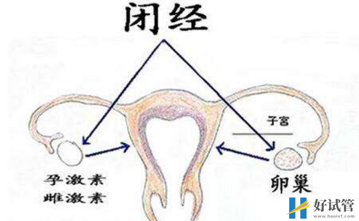 排卵障碍会影响女性月经