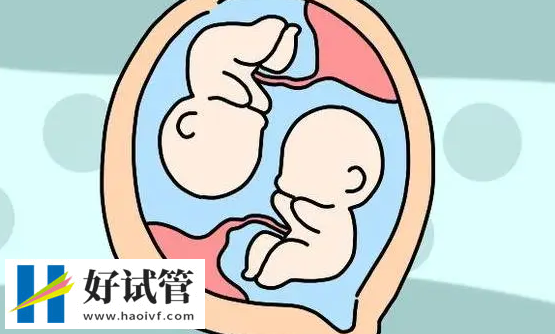 胚胎质量的才能做试管双生子