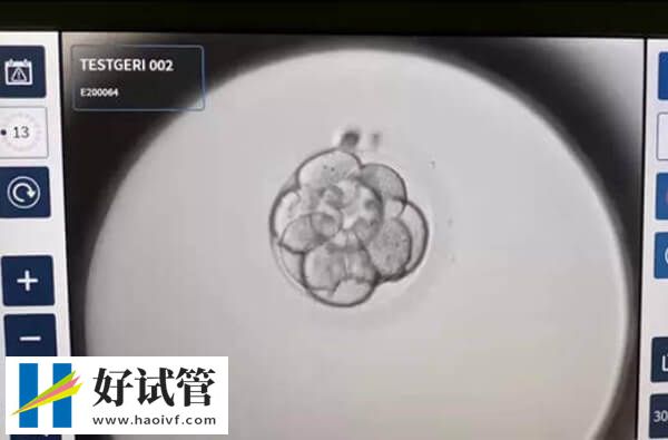 阴超下进行胚胎移植能找准位置
