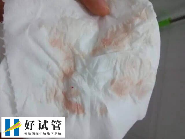 试管移植后少量出血是着床了
