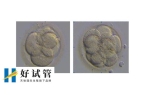 试管婴儿优胚和普胚的区别有哪里