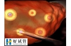 取了21个卵子为何才成了1个胚胎
