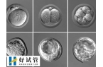 50岁绝经了怎么做试管