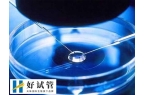 第四代试管技术有什么优势
