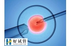 取卵手术会怎么麻醉