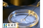 三代试管PGT有几种结果