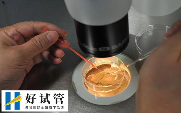 试管成功率和哪些因素有关(图1) 胚胎质量好坏对试管成功率有影响