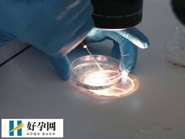 三代试管婴儿流程是怎样的(图2) 试管养囊要收费