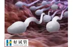 试管婴儿取不出精子怎么办